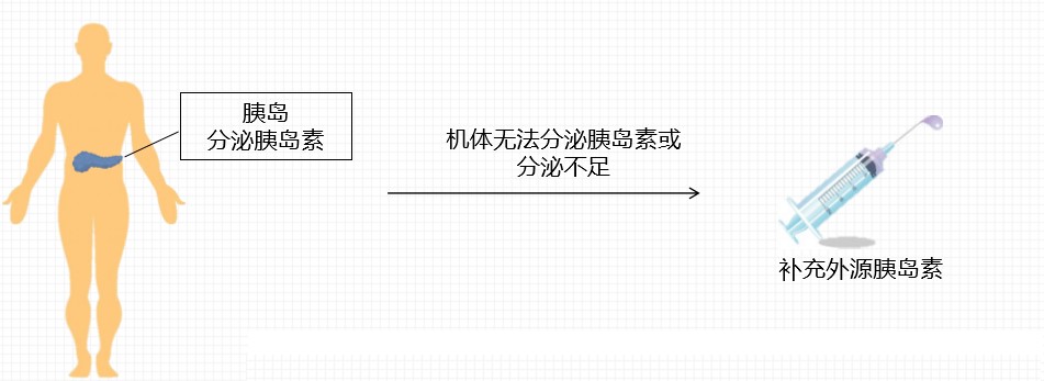 内源胰岛素是自身分泌的一种蛋白质激素;当体内的胰岛素无法分泌或