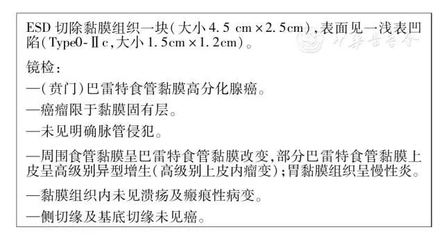 中国巴雷特食管及其早期腺癌筛查与诊治共识(治疗篇)