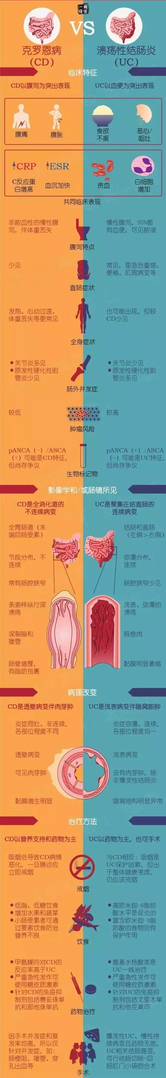 【东方医学情报站】带你一图读懂—第129期:克罗恩病 vs 溃疡性结