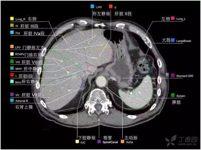 掌握这篇解剖,晋级腹部ct影像诊断高手(精细版)