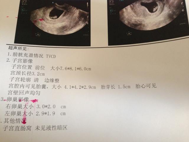正常情况下,怀孕到了6周左右会出现胎芽,孕6～8周在b超下可以见到胎心