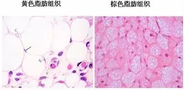 脂肪不但能从"坏"变"好",还能储存下来恢复年轻面容!