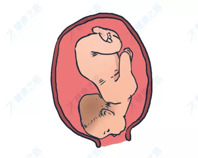 处理: ◆ 如果产妇产力好,胎儿头盆对称,则可先试由阴道自然分娩