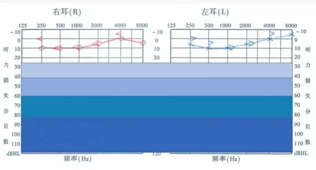 孩子听力有问题我们该怎么办