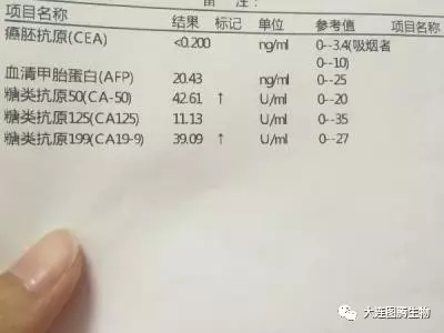 【推荐阅读】肿瘤标志物5大认识误区