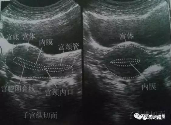 1,子宫:随年龄的增长和内分泌的影响,其大小,形态,宫体与宫颈的比例