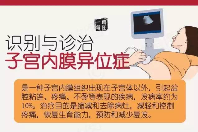 "逃跑的内膜"——子宫内膜异位症