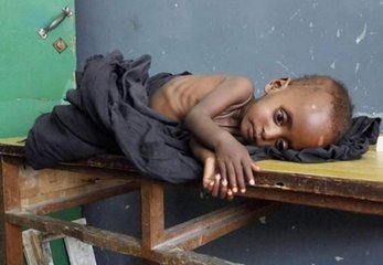 非洲的贫困,孩子没有东西吃,为了不饿只能躺在床上