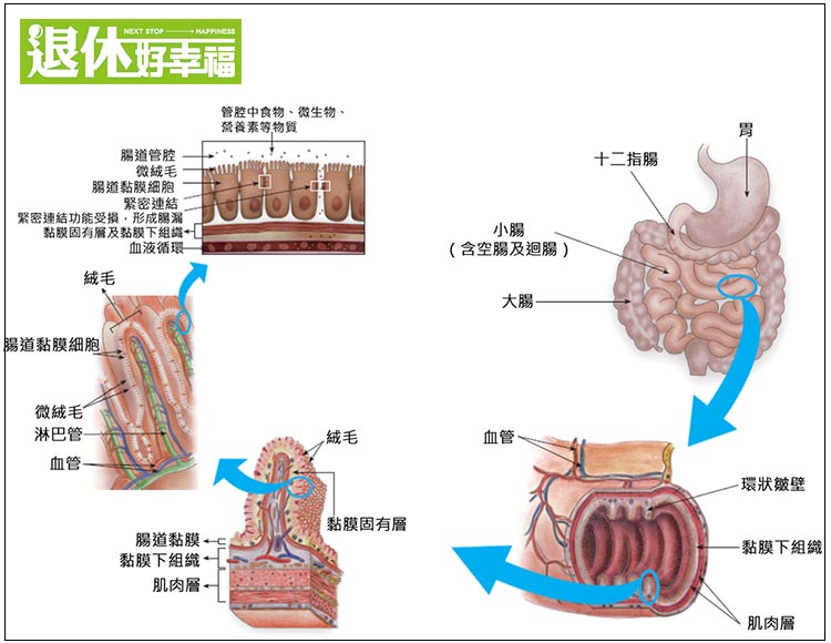 肠子怎么会漏何谓肠漏