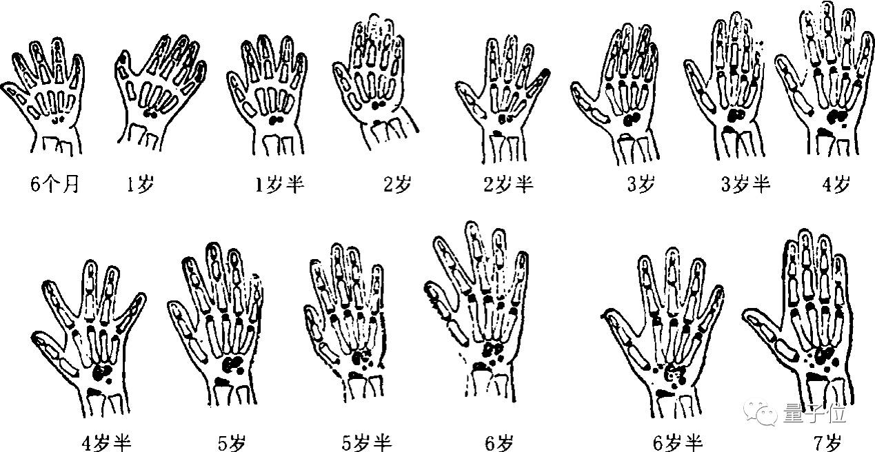 △标准骨龄图谱