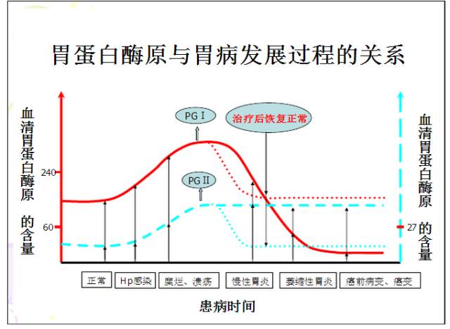 胃蛋白酶原在胃病检测中的重要性