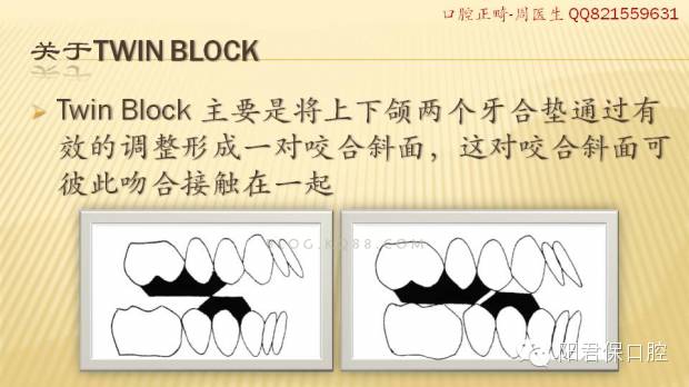 twinblock矫治器