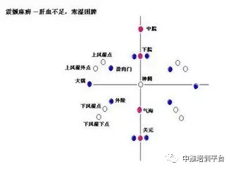 腹针穴位图〖珍贵!收藏!〗