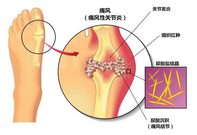 搭飞机耳朵痛怎么调节_耳朵里面痛怎么回事儿(2)