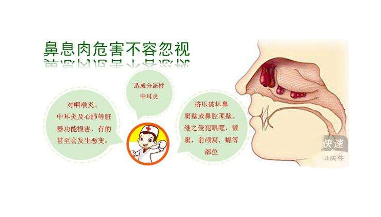 鼻息肉保险可以报销吗 鼻息肉商业保险报销吗