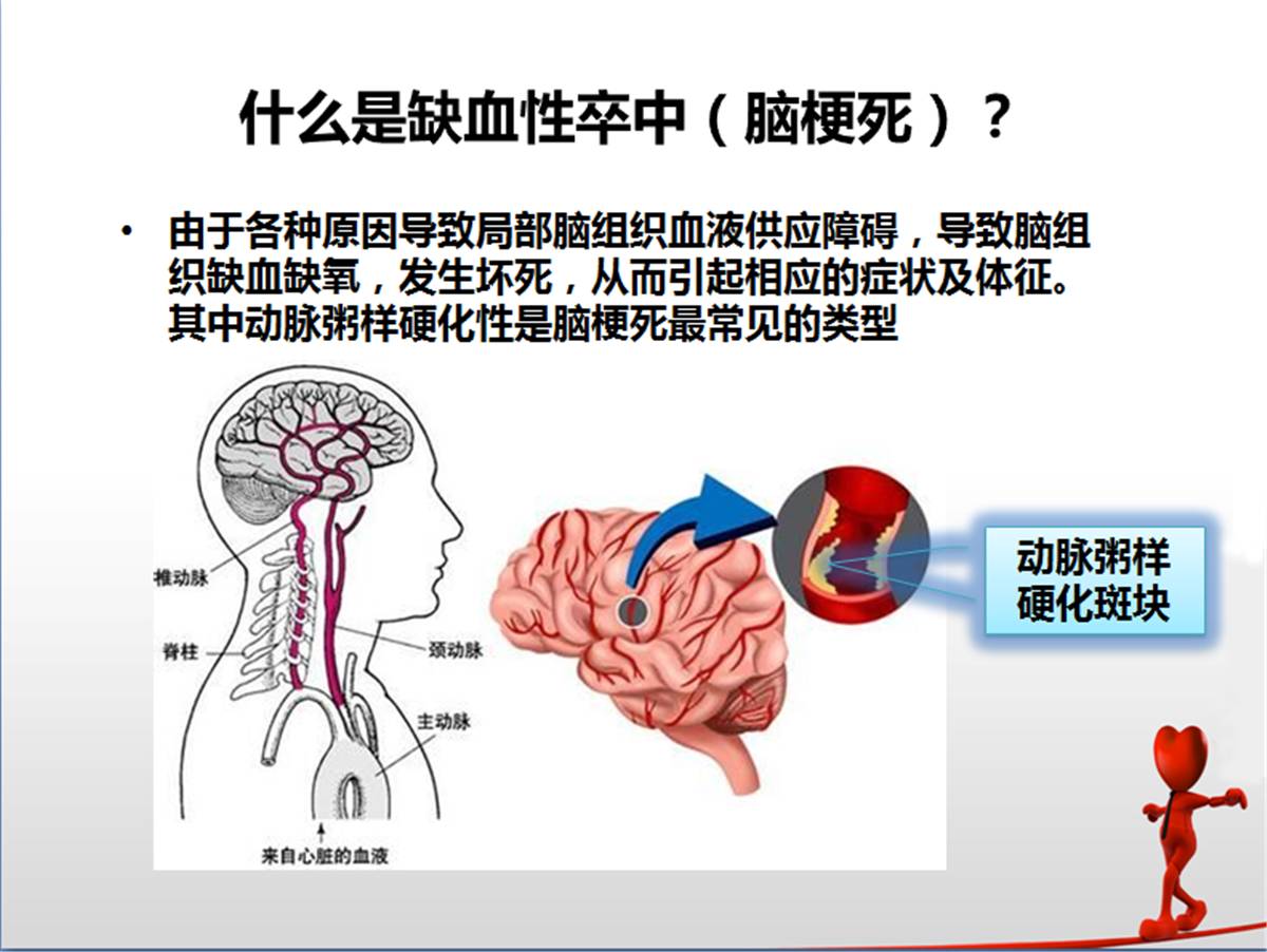 卒中绿色通道——门头沟区医院神经内科携手急诊科共建脑卒中溶栓直通