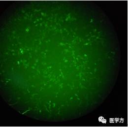 质粒转染的原理和步骤_细胞转染的原理 操作步骤以及小技巧 第二讲(2)