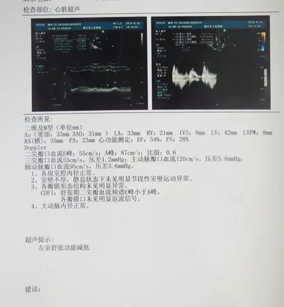 病例分享|张友良:替格瑞洛用于不稳定型心绞痛合并血小板增多症1例