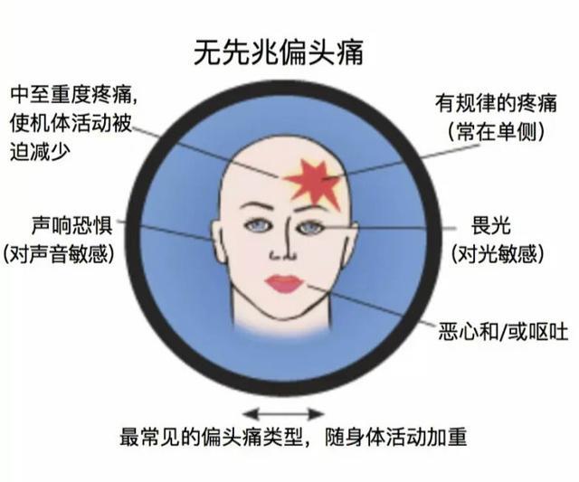 没想到,你以为是小事的头痛有时会致残