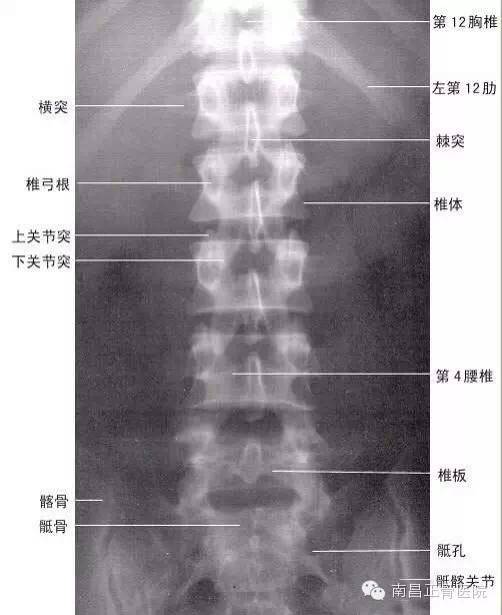 正骨整脊史上最全的骨科x片判读