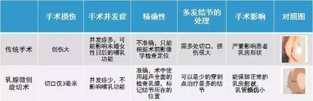 "现在3厘米以下的乳腺肿块都可以用微创技术切除,它的优点显而易见.