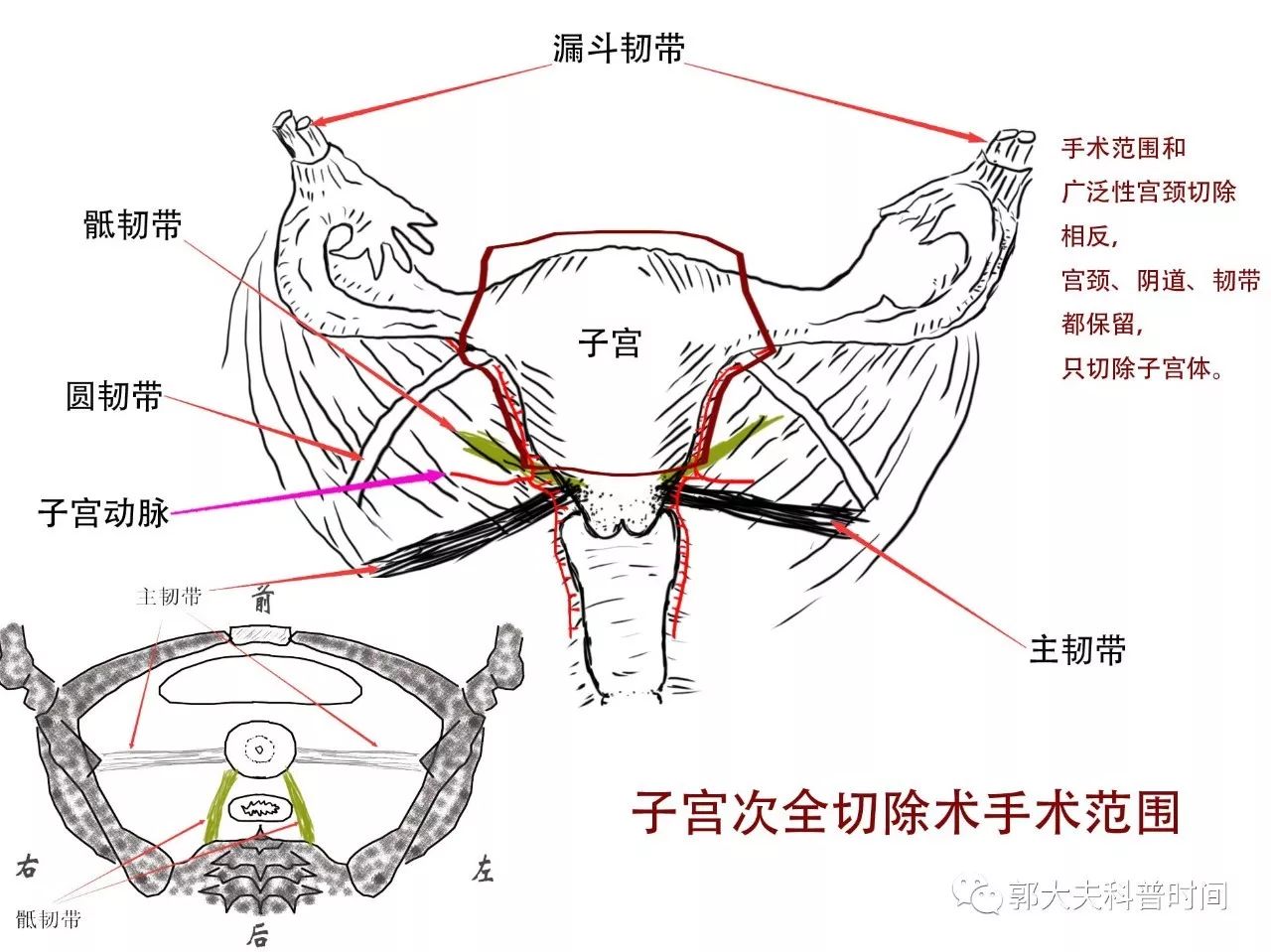 图1-17宫颈组织活检术-妇产科手术-医学