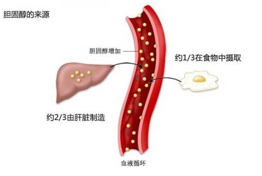 胆固醇偏高怎么办