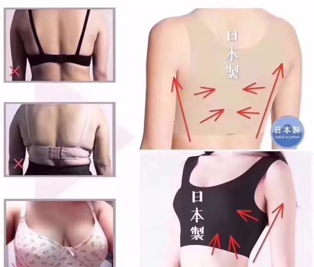 内衣乳腺癌_乳腺癌早期症状图片图(3)