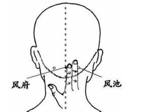 戴眼镜后脑勺疼怎么办