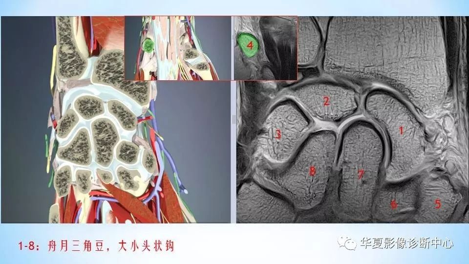 高清腕关节解剖图