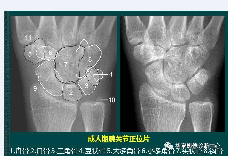 高清腕关节解剖图