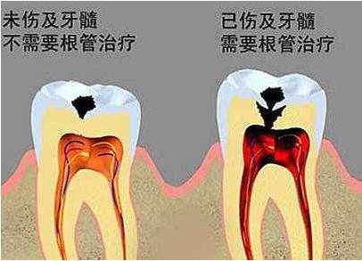 牙齿疼痛的方式有12种之多,那么,你属于哪一种?