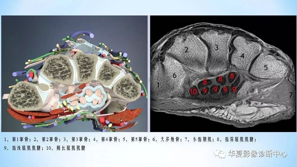 高清腕关节解剖图