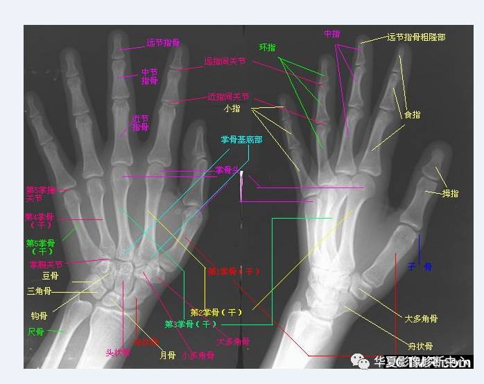 高清腕关节解剖图