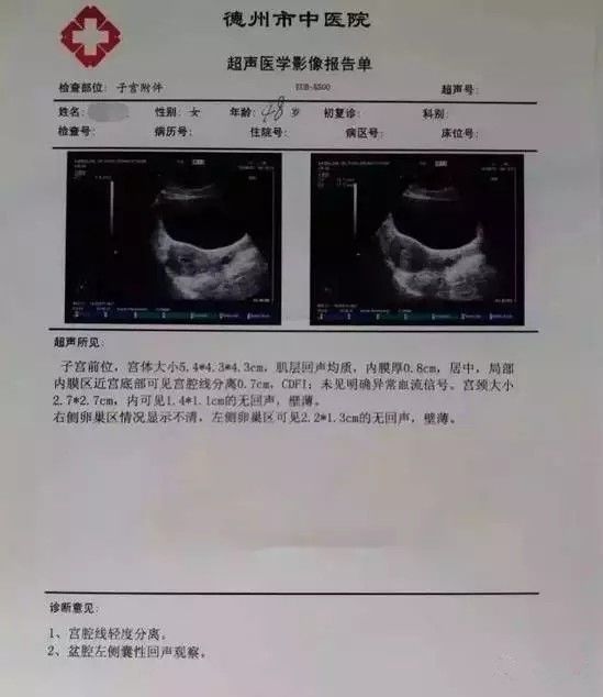 【分享】平衡医学轻松消除宫颈囊肿