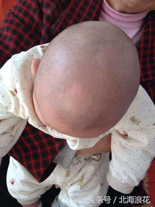 四通管家:三个月的宝宝被爸爸按一下头顶三天后竟死亡!