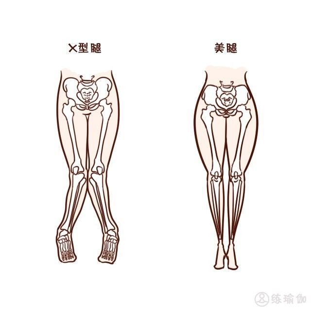 女人双腿合不拢如何有效矫正x型腿ox型腿