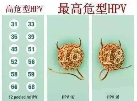 80% 的女性会感染 hpv,宫颈癌离我们有多远?