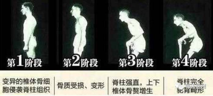 为什么早上起来背疼