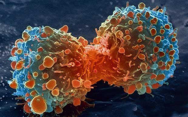 每人每天都长七八千个癌细胞,咋把癌细胞变正常?