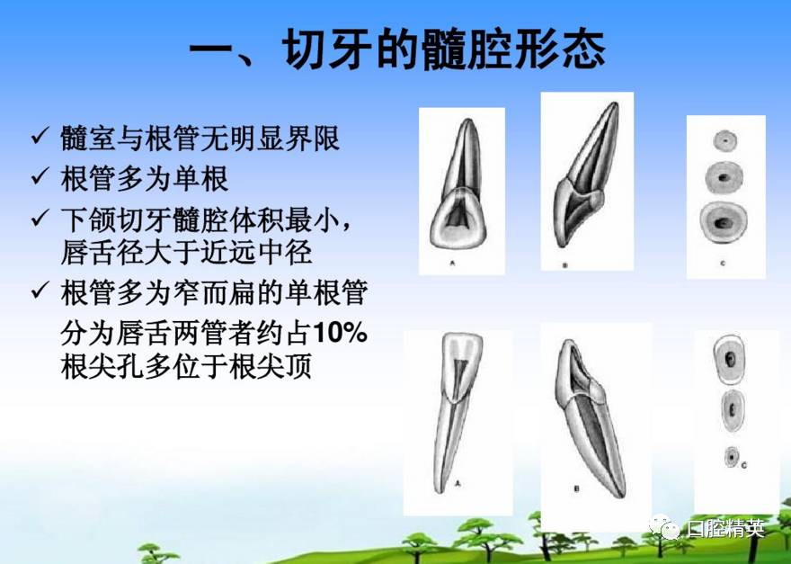 详解:各牙位的开髓【整理版】