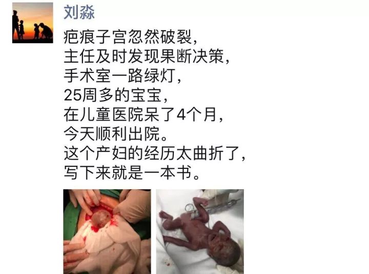 江淮晨报网惊险!产妇子宫被胎儿踹开,羊水全流进腹腔了