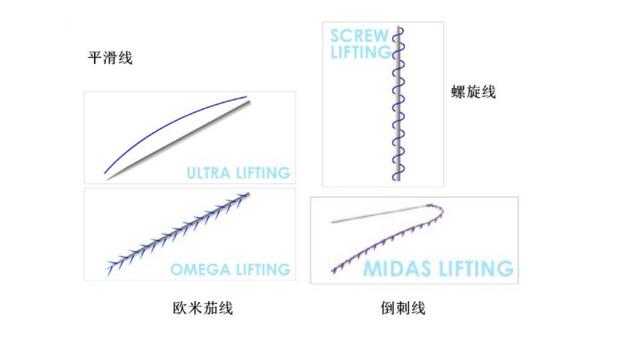 蛋白线提升的原理_蛋白线面部提升术的工作原理是什么