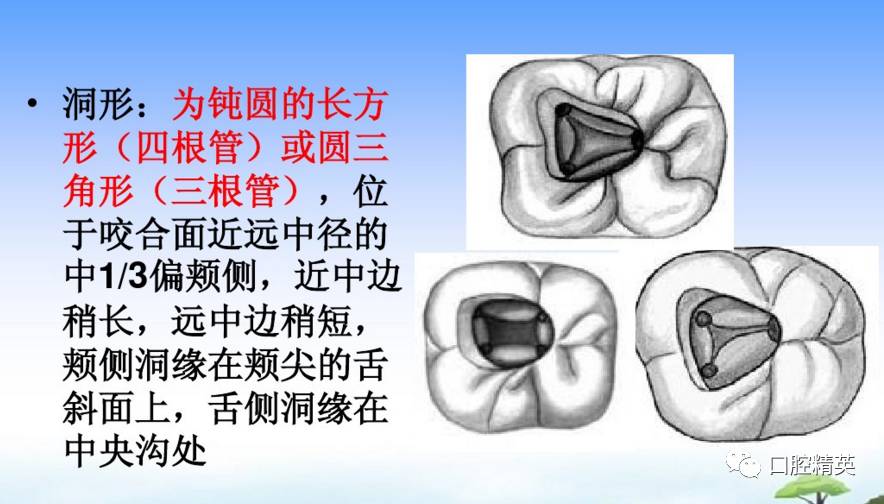 详解:各牙位的开髓【整理版】