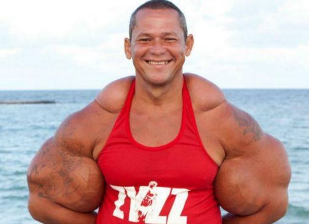 巴西男子拥有世界上最大的肱二头肌,但是皮肤里面却并不是肌肉!