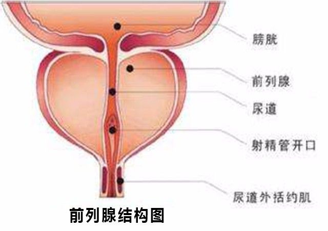 男性疾病自诊(四)|"炎"而无"性"——慢性前列腺炎