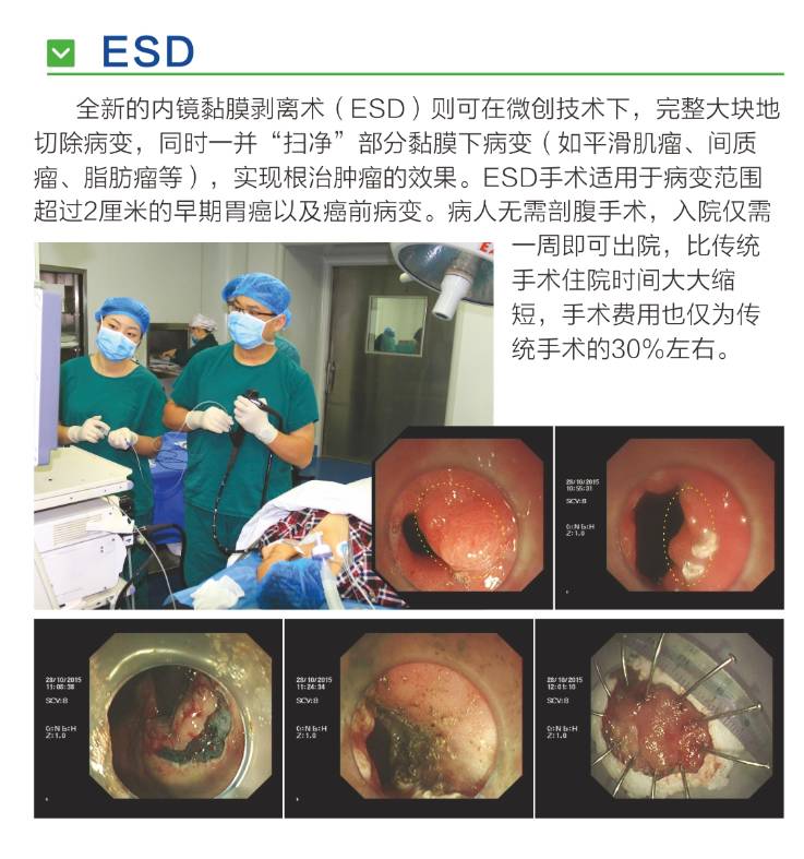 据悉此次升结肠efr手术在安庆市尚属首例,这彰显出海军安庆医院esd