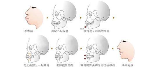 健康 正文  外伤最容易伤及的部位就是颌面部,轻者