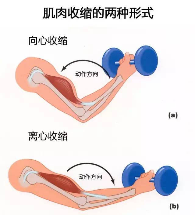 腹部运动后酸痛怎么办