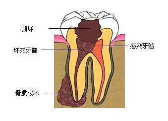 abaac12fea814c68b8cb822054ac4590.jpg